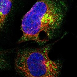 ANKRD40 Antibody, Novus Biologicals 0.1mL; Unlabeled:Antibodies, Polyclonal